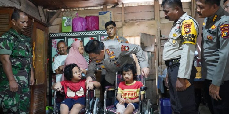 Kapolda Riau Serahkan Bantuan untuk Anak Penderita Tulang Rapuh
