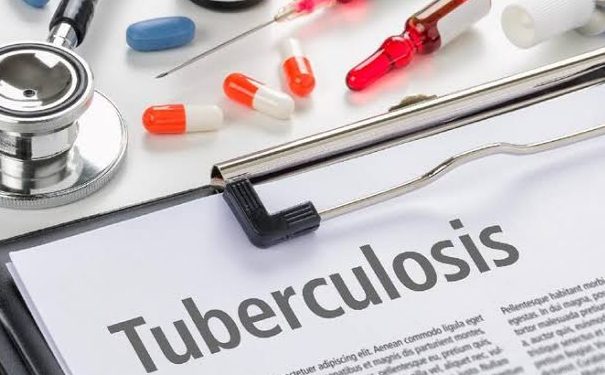 Waspadai Potensi Penularan TBC melalui Droplet